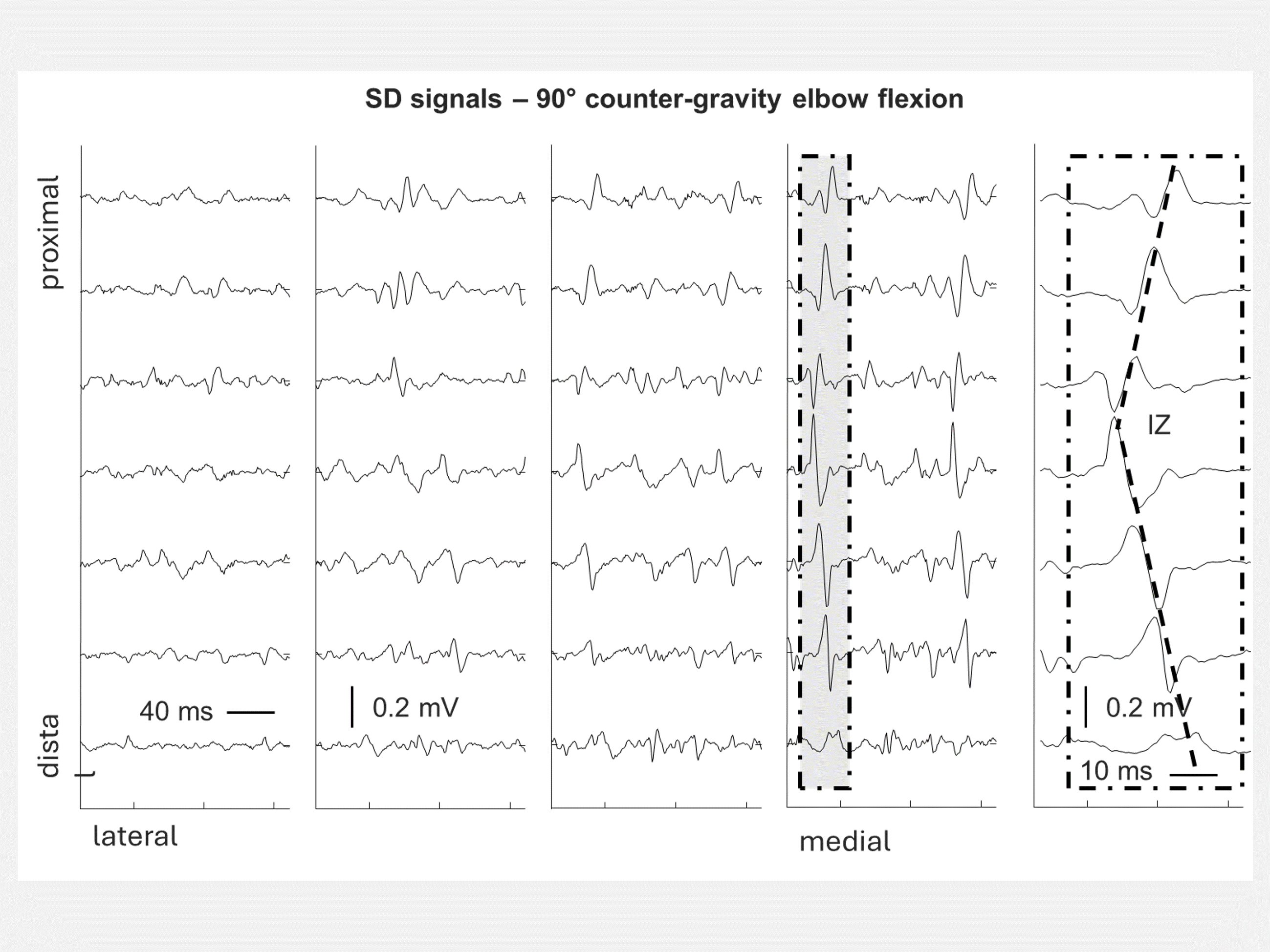 Applications in basic neurophysiology